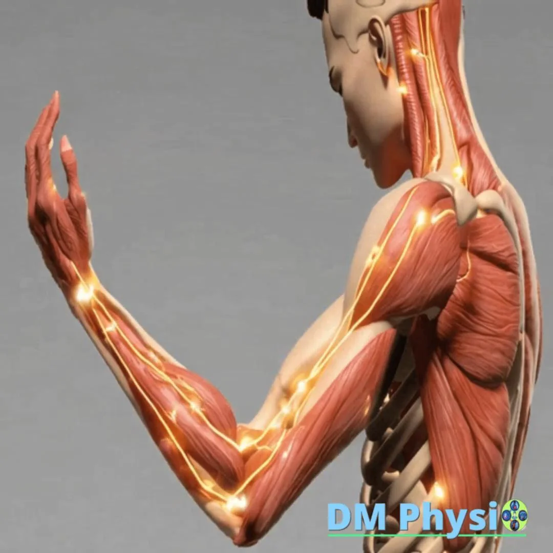 Изображение на невралгии по ръката